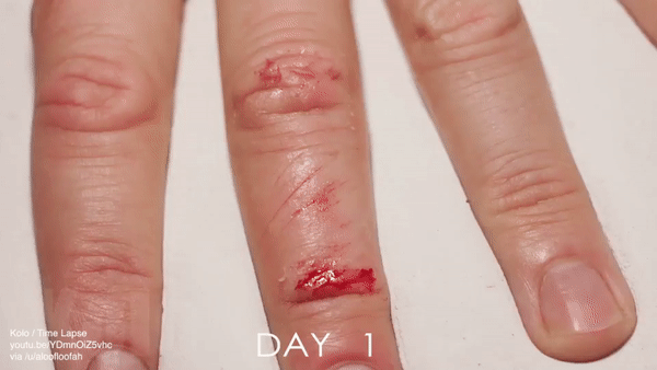 Un fantastique timelapse d'une guérison de coupure de doigt