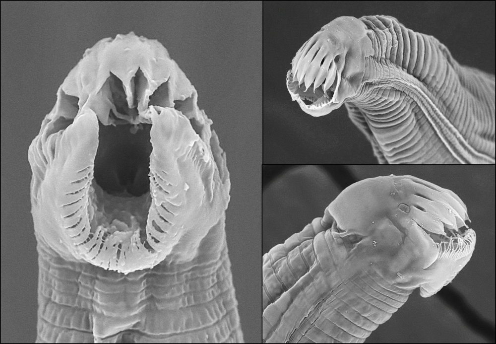 Les hôtes de parasites peuvent cacher bien des merveilles. Admirez ainsi les nématodes trouvés dans le système digestif de mille-pattes!