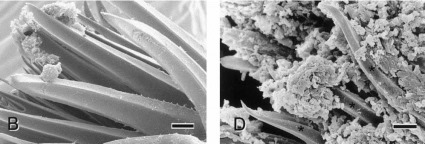 Croissance d’un biofilm de Yersinia pestis sur les épines du proventricule d’une puce vue au microscope électronique à balayage