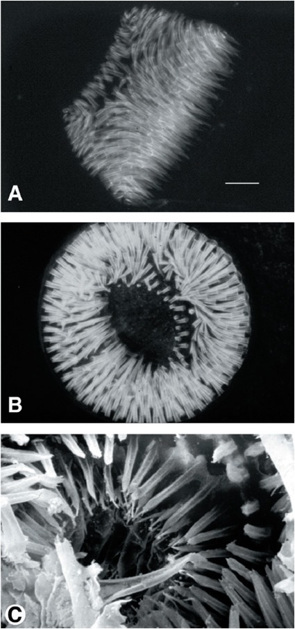 Epines du proventricule de la puce Xenopsylla cheopis, les deux premières photos en fluorescence (les épines sont auto-fluorescentes) et la 3ème au microscope électronique à balayage