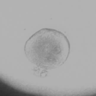 Clivage d'un embryon humain